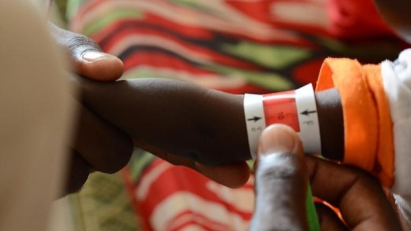 Messung des Oberarmumfangs eines Kindes in der Klinik von Ärzte ohne Grenzen im Camp Samsam in Nord-Darfur. Dies ist eine unverzichtbare Massnahme, um Mangelernährung festzustellen. © Mohammed Jamal